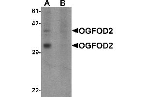 Western blot analysis of OGFOD2 in 293 cell lysate with OGFOD2 antibody at 1 µg/mL in (A) the absence and (B) the presence of blocking peptide. (OGFOD2 Antikörper  (Middle Region))