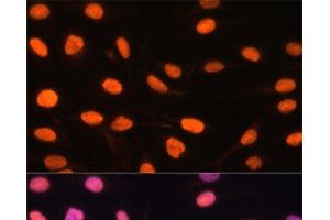 Immunofluorescence analysis of U-2 OS cells using ZBED1 Polyclonal Antibody at dilution of 1:100. (ZBED1 Antikörper)