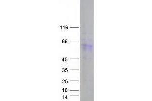 Validation with Western Blot (DAZ4 Protein (Transcript Variant 2) (Myc-DYKDDDDK Tag))