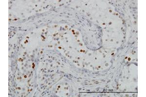 Immunoperoxidase of monoclonal antibody to BRD3 on formalin-fixed paraffin-embedded human testis. (BRD3 Antikörper  (AA 418-556))
