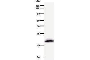 Western Blotting (WB) image for anti-Deoxycytidine Kinase (DCK) antibody (ABIN931037) (DCK Antikörper)