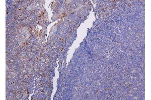 anti-Chemokine (C-X-C Motif) Receptor 2 (CXCR2) (AA 32-54) antibody