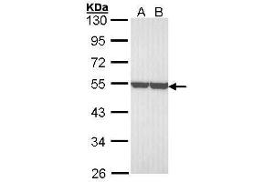 WB Image Sample (30 ug of whole cell lysate) A: A431 , B: H1299 10% SDS PAGE antibody diluted at 1:3000 (ENO1 Antikörper)