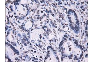 Image no. 7 for anti-Replication Protein A2, 32kDa (RPA2) antibody (ABIN1500735)