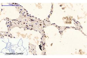 Immunohistochemical analysis of paraffin-embedded human lung tissue. (ERK1/2 Antikörper  (pTyr205, pTyr222))