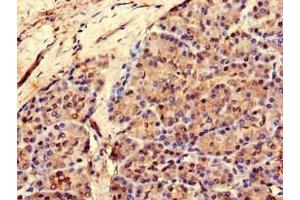 Immunohistochemistry of paraffin-embedded human pancreatic tissue using ABIN7167725 at dilution of 1:100 (RCOR3 Antikörper  (AA 1-300))