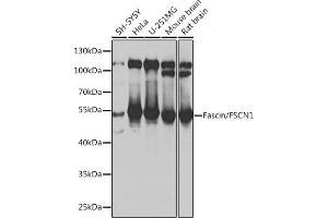 Western blot analysis of extracts of various cell lines, using Fascin/Fascin/FSCN1 antibody (ABIN6131667, ABIN6140779, ABIN6140780 and ABIN6217317) at 1:1000 dilution. (Fascin Antikörper  (AA 260-380))