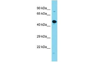 Host: Rabbit Target Name: GPATCH2L Sample Type: Fetal Brain lysates Antibody Dilution: 1. (GPATCH2L Antikörper  (Middle Region))