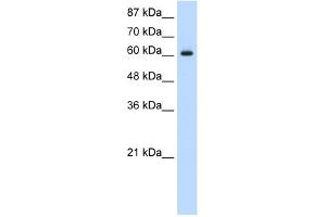 Western Blot showing HIF3A antibody used at a concentration of 1-2 ug/ml to detect its target protein. (HIF3A Antikörper  (C-Term))
