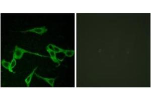 Immunofluorescence analysis of LOVO cells, using HRH2 Antibody. (HRH2 Antikörper  (AA 131-180))