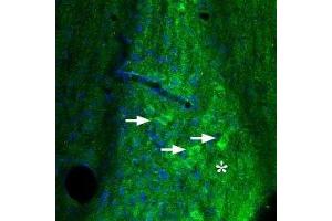 Expression of Adenosine A2A Receptor in mouse diagonal band - Immunohistochemical staining of mouse diagonal band using Anti-Adenosine A2A Receptor Antibody (ABIN7042883, ABIN7043888 and ABIN7043889). (Adenosine A2a Receptor Antikörper  (AA 201-215))