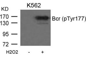 Western blot analysis of extracts from K562 cells untreated or treated with H2O2 using Bcr(Phospho-Tyr177) Antibody. (BCR Antikörper  (pTyr177))