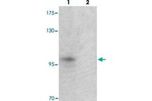 Western blot analysis of TSHZ2 in A-20 cell lysate with TSHZ2 polyclonal antibody  at 1 ug/mL in (lane 1) the absence and (lane 2) the presence of blocking peptide. (TSHZ2 Antikörper  (N-Term))
