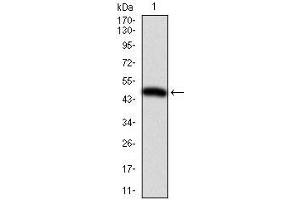 Western blot analysis using ITGB1 mAb against human ITGB1 (AA: 50-270) recombinant protein. (ITGB1 Antikörper)