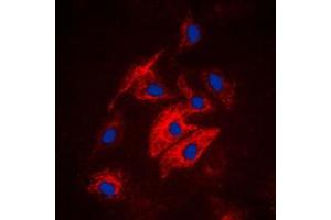 Immunofluorescent analysis of MAST4 staining in HuvEc cells. (MAST4 Antikörper  (N-Term))
