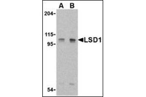 Western blot analysis of LSD1 in P815 cell lysate with this product at (A) 1 and (B) 2 μg/ml. (LSD1 Antikörper  (Center))