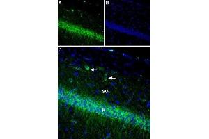 Immunohistochemistry (IHC) image for anti-Potassium Voltage-Gated Channel, Shab-Related Subfamily, Member 1 (KCNB1) (AA 841-857), (Intracellular) antibody (ABIN7043508)