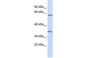 Western Blotting (WB) image for anti-Tripartite Motif Containing 8 (TRIM8) antibody (ABIN2458103) (TRIM8 Antikörper)
