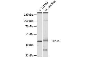 Western blot analysis of extracts of various cell lines, using TR antibody (ABIN7270934) at 1:1000 dilution. (TRAM1 Antikörper  (AA 305-374))