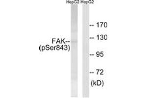 Western blot analysis of extracts from HepG2 cells treated with PMA 125ng/ml 20', using FAK (Phospho-Ser843) Antibody. (FAK Antikörper  (pSer843))