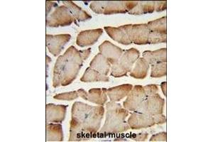 Formalin-fixed and paraffin-embedded human skeletal muscle reacted with T150A Antibody (Center), which was peroxidase-conjugated to the secondary antibody, followed by DAB staining. (TMEM150A Antikörper  (AA 81-108))