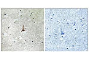 Immunohistochemistry (IHC) image for anti-Low Density Lipoprotein Receptor Related Protein 10 (LRP10) (Internal Region) antibody (ABIN1851503) (LRP10 Antikörper  (Internal Region))