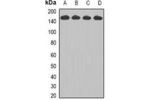 Western blot analysis of CCAR1 expression in Jurkat (A), HepG2 (B), A549 (C), A431 (D) whole cell lysates. (CCAR1 Antikörper)