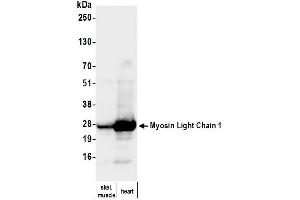 Western Blotting (WB) image for anti-Myosin, Light Chain 1, Alkali, Skeletal, Fast (MYL1) (Light Chain) antibody (ABIN7795614)