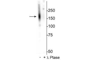 Western blot of mouse kidney lysate showing specific immunolabeling of the ~160 kDa NCC protein phosphorylated at Thr53 in the first lane (-). (SLC12A3 Antikörper  (pThr53))