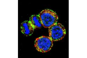 Confocal immunofluorescent analysis of BIRC3 Antibody (N-term) (ABIN657941 and ABIN2846885) with MDA-M cell followed by Alexa Fluor 488-conjugated goat anti-rabbit lgG (green). (BIRC3 Antikörper  (N-Term))