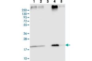 Western blot analysis of Lane 1: RT-4, Lane 2: U-251 MG, Lane 3: Human Plasma, Lane 4: Liver, Lane 5: Tonsil with TMEM205 polyclonal antibody . (TMEM205 Antikörper)