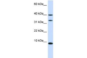 Western Blotting (WB) image for anti-Diazepam Binding Inhibitor (DBI) (N-Term) antibody (ABIN2777771)