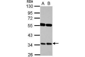 WB Image Sample (30 ug of whole cell lysate) A: Raji B: K562 10% SDS PAGE antibody diluted at 1:1000 (RASSF7 Antikörper  (Center))