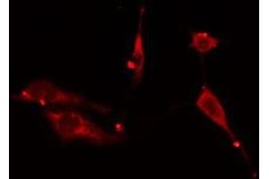 ABIN6276614 staining HuvEc cells by IF/ICC. (ARHGDIA Antikörper  (N-Term))