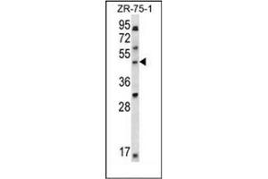 Western blot analysis of LDB1 Antibody (C-term) in ZR-75-1 cell line lysates (35ug/lane). (LIM Domain Binding 1 Protein Antikörper  (C-Term))