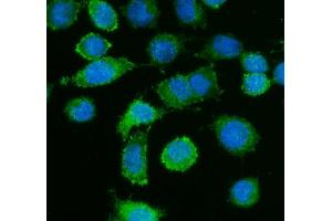 IF analysis of Caldesmon using anti-Caldesmon antibody (ABIN4886498). (Caldesmon Antikörper  (AA 1-120))
