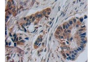 Immunohistochemistry (IHC) image for anti-Disrupted in Schizophrenia 1 (DISC1) (AA 102-261) antibody (ABIN7439720)