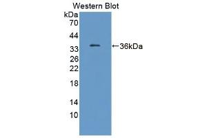 Detection of Recombinant TKT, Human using Polyclonal Antibody to Transketolase (TKT) (TKT Antikörper  (AA 1-294))