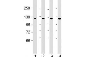 Western blot testing of 1) human DU-145, 2) human HepG2, 3) mouse brain and 4) HeLa cell lysate with AIP1 antibody at 1:1000.