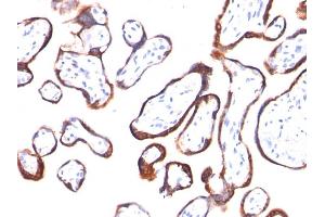 Formalin-fixed, paraffin-embedded human Placenta stained with hCG beta Mouse Monoclonal Antibody (HCGb/54). (CGB Antikörper)