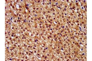 IHC image of ABIN7146392 diluted at 1:400 and staining in paraffin-embedded human adrenal gland tissue performed on a Leica BondTM system. (PNPLA8 Antikörper  (AA 158-345))