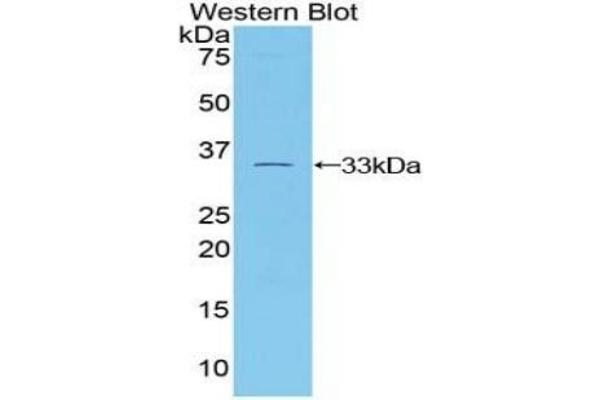 TUBB1 Antikörper  (AA 182-437)