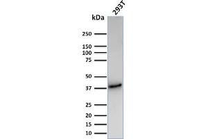 Western Blot Analysis of Human 293T cell lysate using CD74 Recombinant Rabbit Monoclonal Antibody (CLIP/3127R). (Rekombinanter CD74 Antikörper)