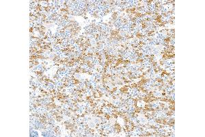 Immunohistochemistry (IHC) image for anti-Carcinoembryonic Antigen-Related Cell Adhesion Molecule 1 (CEACAM1) (AA 35-141) antibody (ABIN7455130)