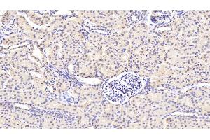 Immunohistochemistry (IHC) image for anti-Guanylate Cyclase 1, Soluble, beta 3 (GUCY1B3) (AA 408-619) antibody (ABIN7441526)