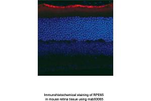 Image no. 2 for anti-Retinal Pigment Epithelium-Specific Protein 65kDa (RPE65) antibody (ABIN363219)