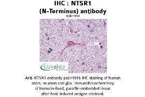 Image no. 1 for anti-Neurotensin Receptor 1 (High Affinity) (NTSR1) (Extracellular Domain), (N-Term) antibody (ABIN1737567) (NTSR1 Antikörper  (Extracellular Domain, N-Term))