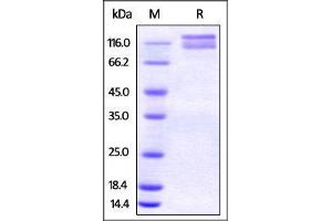 Human ITGAV & ITGB6 Heterodimer Protein on SDS-PAGE under reducing (R) condition.