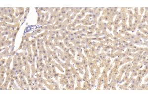 Detection of TNFa in Rabbit Liver Tissue using Monoclonal Antibody to Tumor Necrosis Factor Alpha (TNFa) (TNF alpha Antikörper  (AA 80-235))