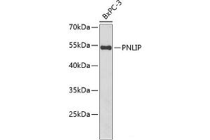 Western blot analysis of extracts of BxPC-3 cells using PNLIP Polyclonal Antibody at dilution of 1:1000. (PNLIP Antikörper)